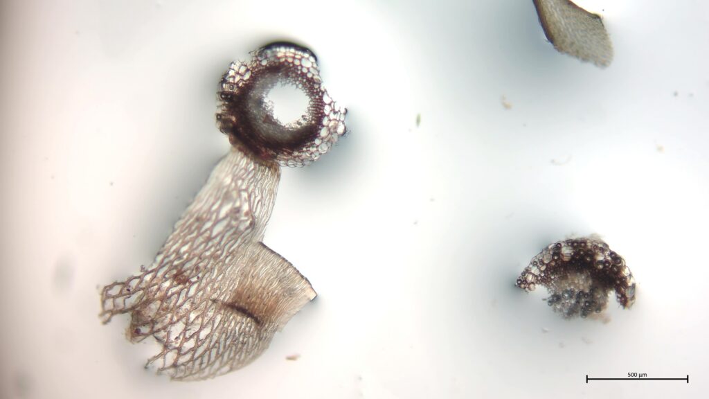 Stammquerschnitt von Sphagnum lindbergii