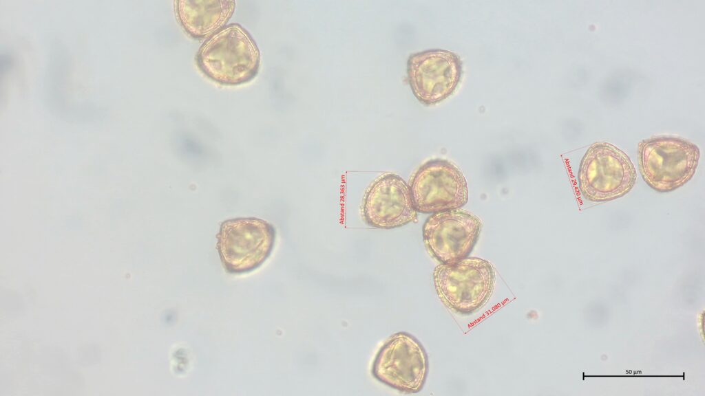 Sphagnum palustre Sporen