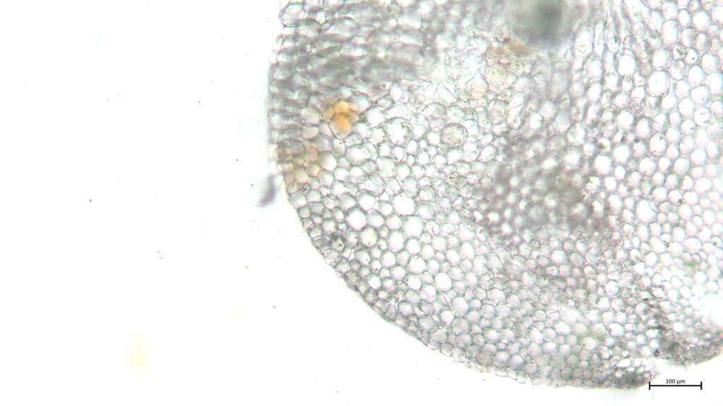 Stammquerschnitt von Sphagnum riparium