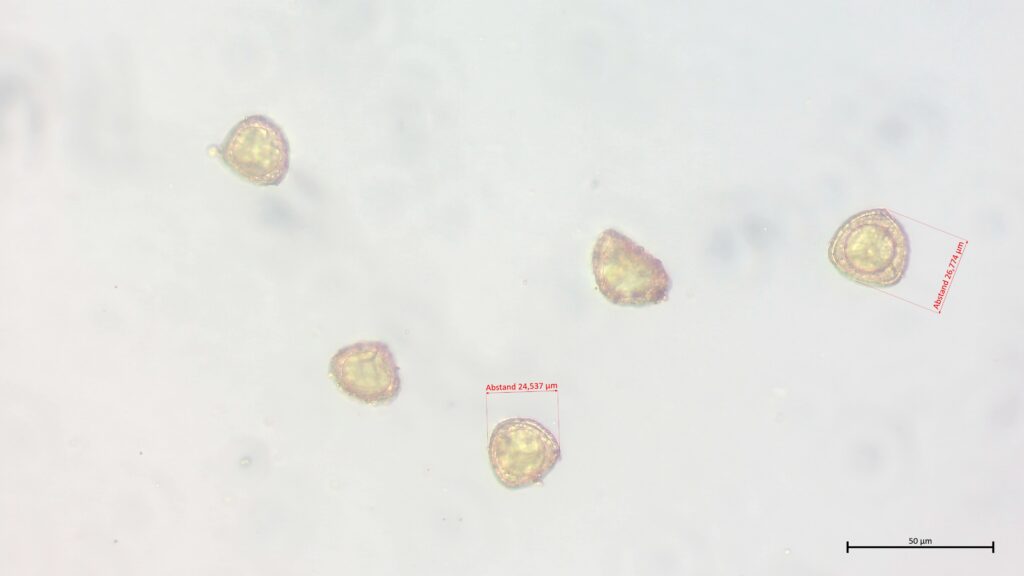Sporen von Sphagnum subnitens